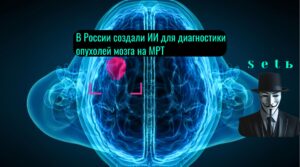 В России создали ИИ для диагностики опухолей мозга на МРТ